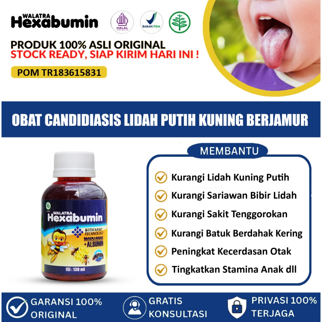 Obat Candidiasis Mulut, Lidah, Jamur Lidah, Mulut Berjamur, Becak Putih Atau   Kuning Di Lidah, Aman