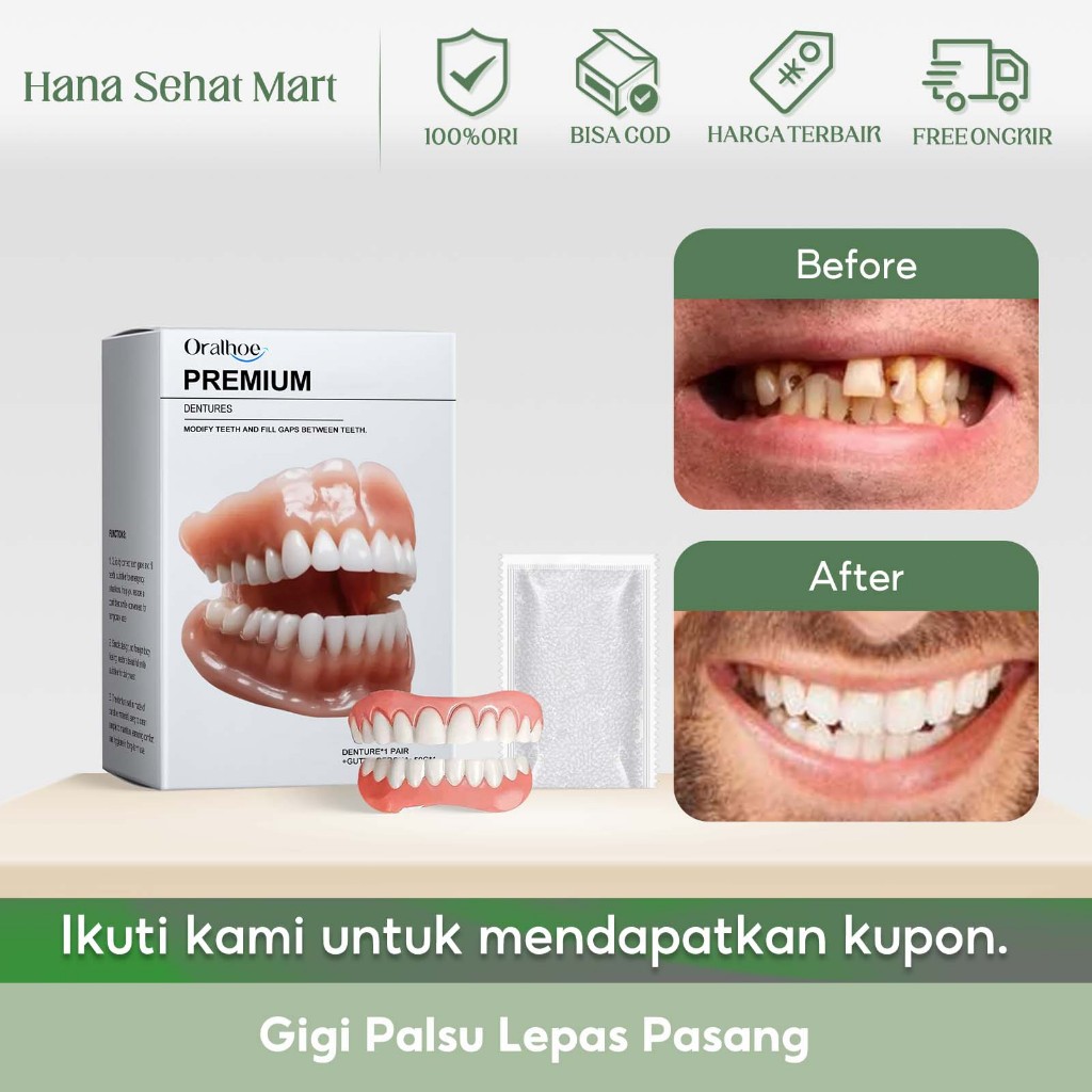 Oralhoe Gigi Palsu Lepas Pasang 1set Gigi Palsu Senyum Sempurna Gigi Veneer Gigi Palsu Lepas Pasang 