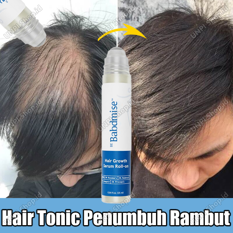 Hair Tonic Penumbuh Rambut  Botak Roller Rosemary Oil Rambut Minyak Penumbuh Rambut Cepat Dan Tebal 