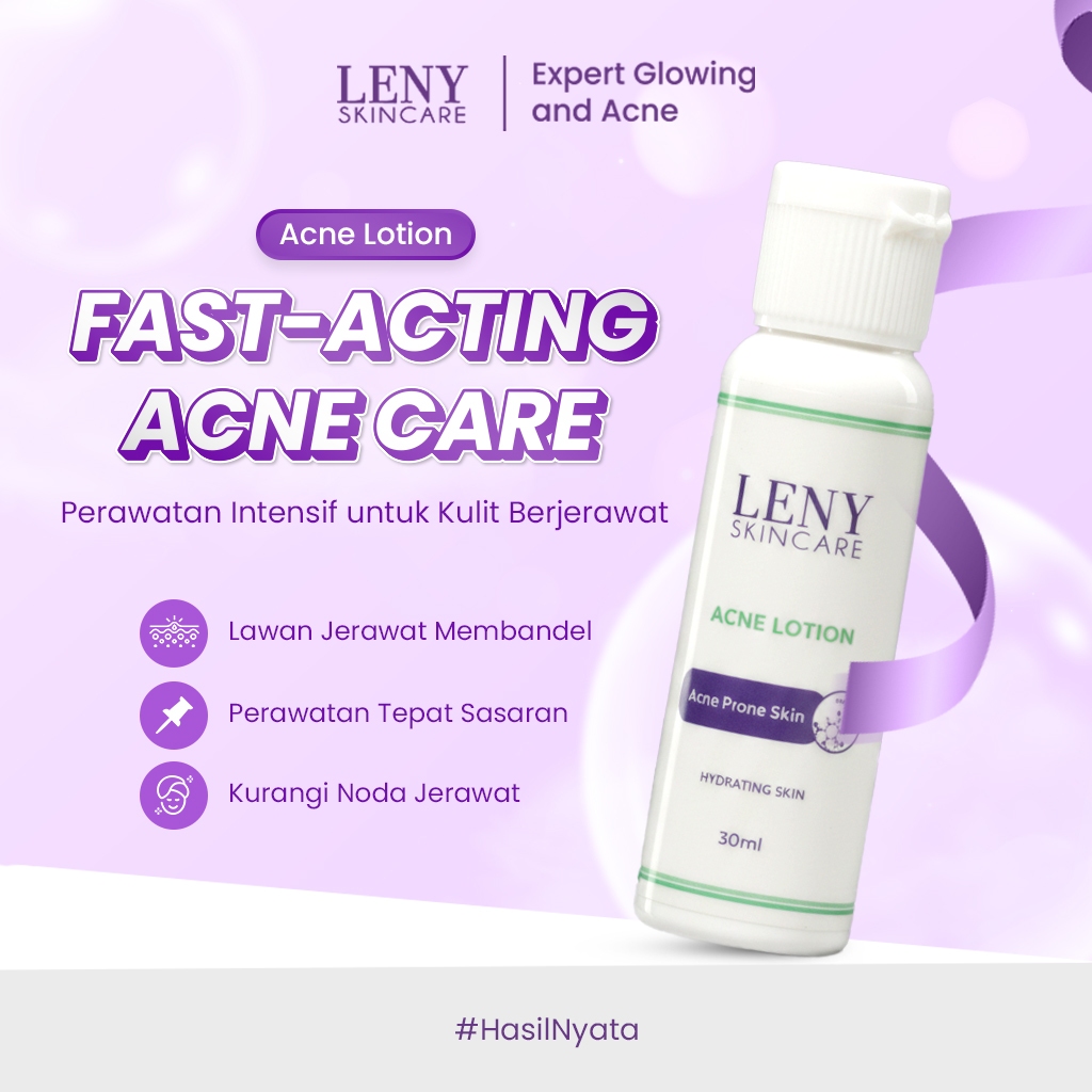 LENY SKINCARE Acne Lotion 30 ml Lotion Perawatan Kulit Berjerawat