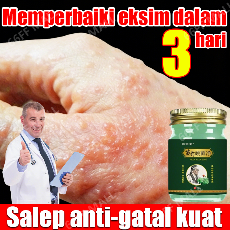salap gatal kulit yang ampuh salep eksim obt gatal seluruh badan obat gatal selangkangan salep jamur