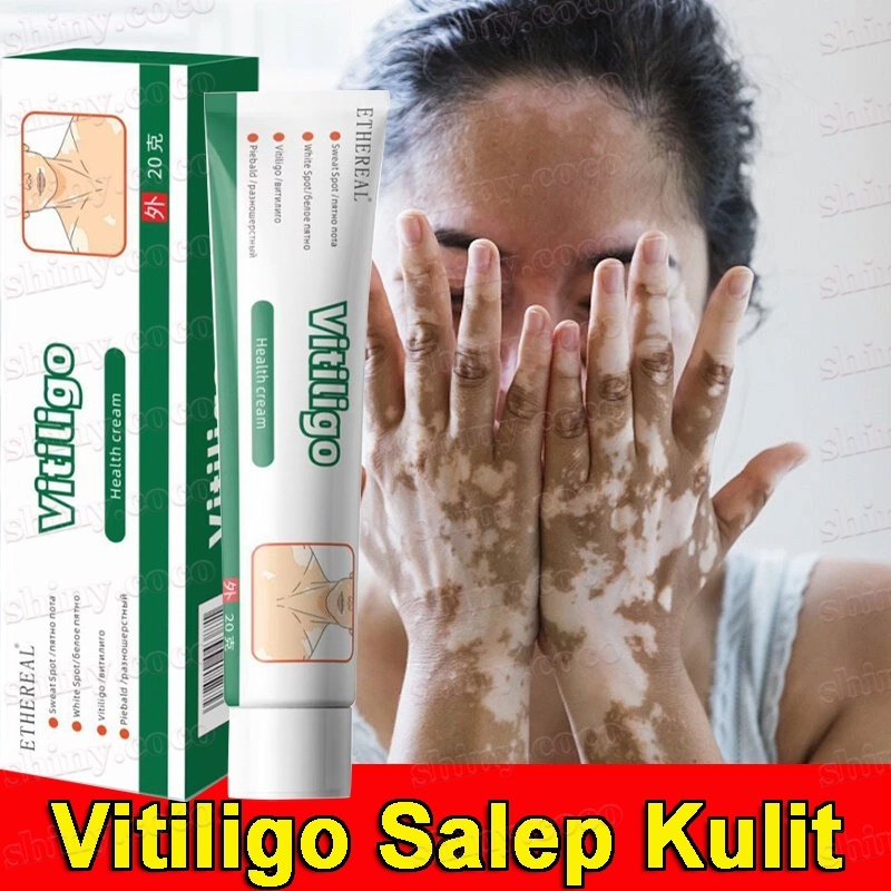 Vitiligo Salep Kulit Obat Penghilang Vitiligo Kulit Bercak Putih Jerawat Keringat Krim Concealer Nod