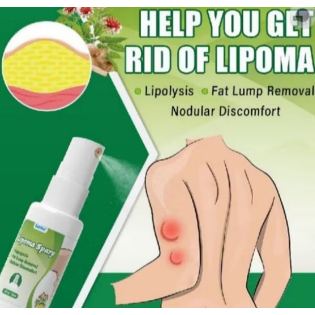 Sumifun Lipoma Spray - semprotan lipoma benjolan - obat lipoma benjolan