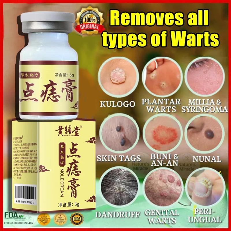 Efek bagus Obat Kutil paling ampuh Oles Penghilang Kutil manjur tanpa operasi mahal penghapus mengha