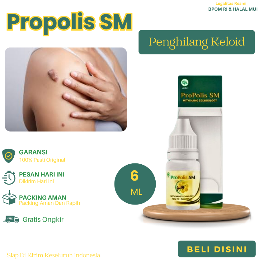 Obat Untuk Penghilang Keloid, Keloid Menonjol Tahunan, Benjolan Keras, Bekas Luka Yang Lama, Penghil