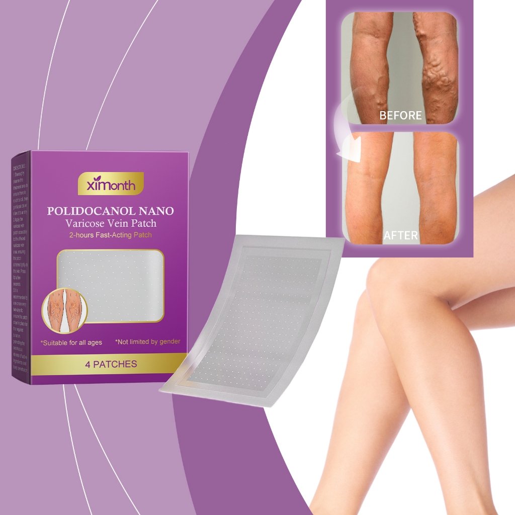 Ximonth Varicose Vein Patch 4pcs Koyo Herbal Penyembuhan Varises Memperbaiki Varises Meredakan Nyeri