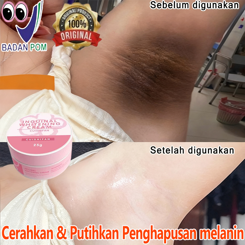 memutihkan ketiak dan selangkangan pemutih ketiak ampuh dan cepat pemutih selakangan hitam whitening