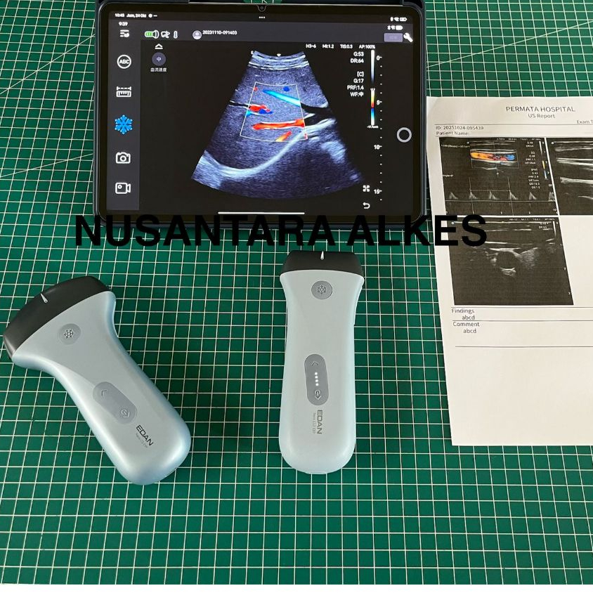 PORTABLE ULTRASOUND SCANNER EDAN NANO C5 EXP / USG WIRELESS EDAN NANO C5 EXP / USG WIRELESS POCKET E