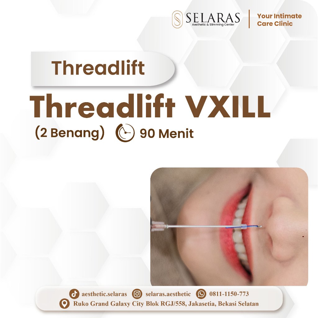 Threadlift VXILL (2 Benang) - Treatment