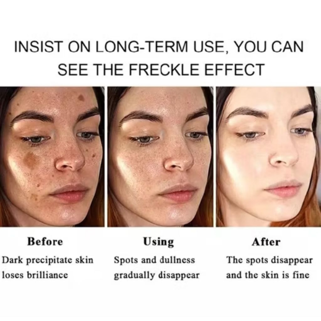 youbuy whitening and freckle removing cream