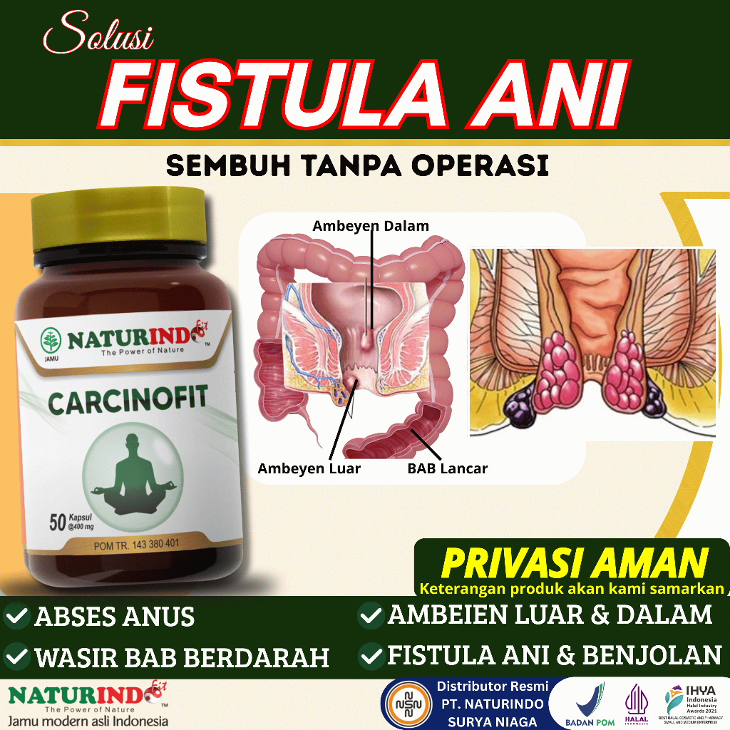 Obat Fistula Ani Bisul di Pantat Bisul Bernanah Herbal Abses Perianal Carcinofit Pos K Obat Bisul Ob