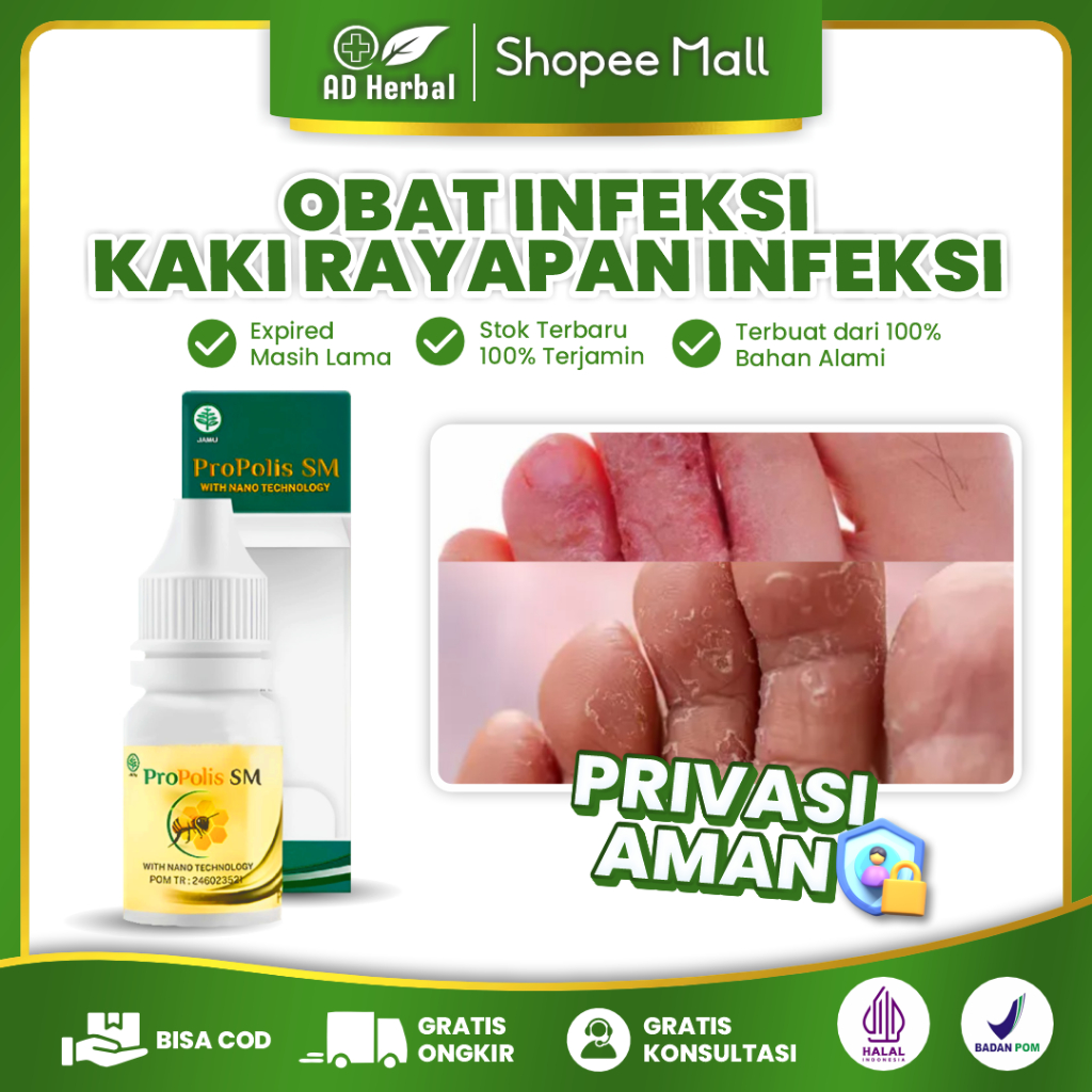 Obat Infeksi Kaki Rayapan Infeksi telapak kaki Kutu air Jamur di telapak kaki & tangan infeksi kuku 