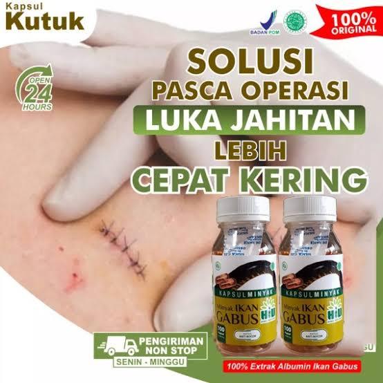Kapsul Hiu Minyak Ikan Gabus - Bantu Keringkan Pasca Operasi