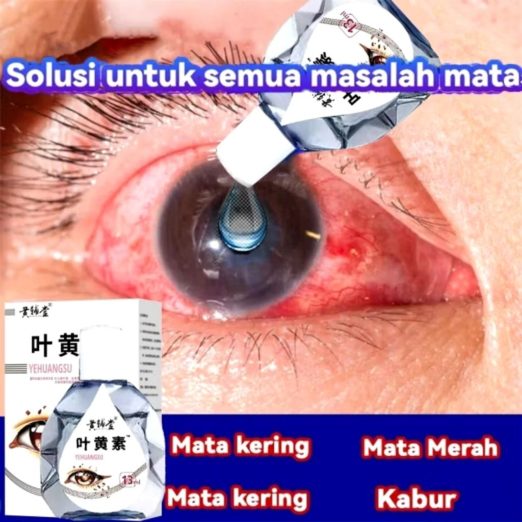 Obat Tetes Mata untuk Katarak | Obat Mata Rabun | Cuci Mata | Tetes Mata untuk Mata Kering | Obat Ma