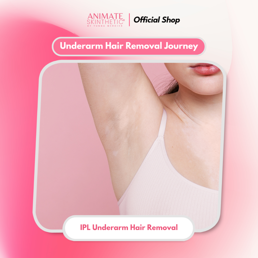 Underarm Hair Removal Journey - 12x IPL Underarm Hair Removal