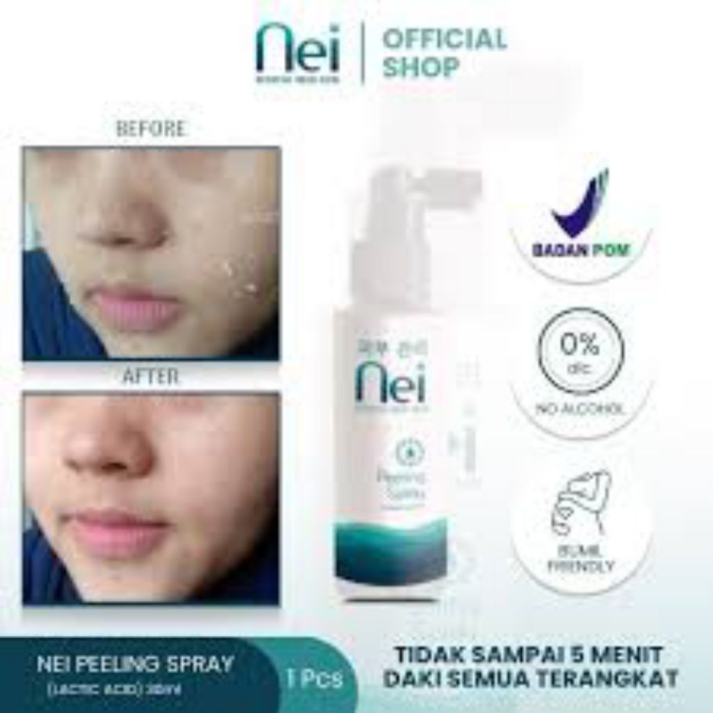 Nei Peeling Spray Perontok Daki Dan Sel Kulit MatiMembandel