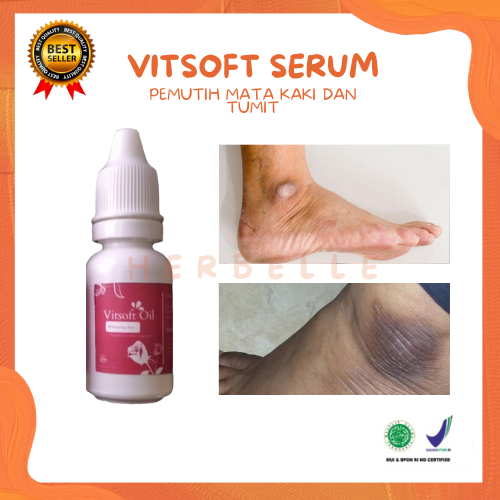 OBAT TETES SERUM VITSOFT Menghilangkan Noda Hitam Dan Flek Hitam Di Mata Kaki