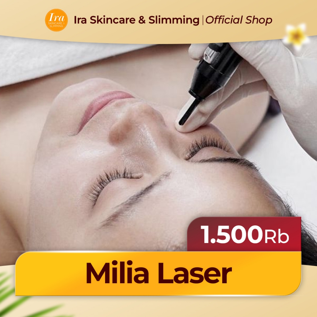IRA SKINCARE | Milia Laser Removal