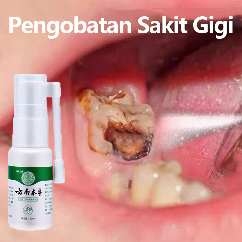 PALING AMPUH HERBAL CHINA obat sakit gigi Berlobang dan gusi bengkak untuk anak Dan dewasa