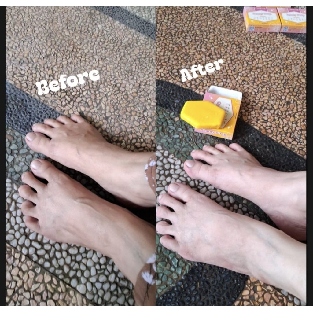 Sabun pemutih Oisure beauty soap BPOM