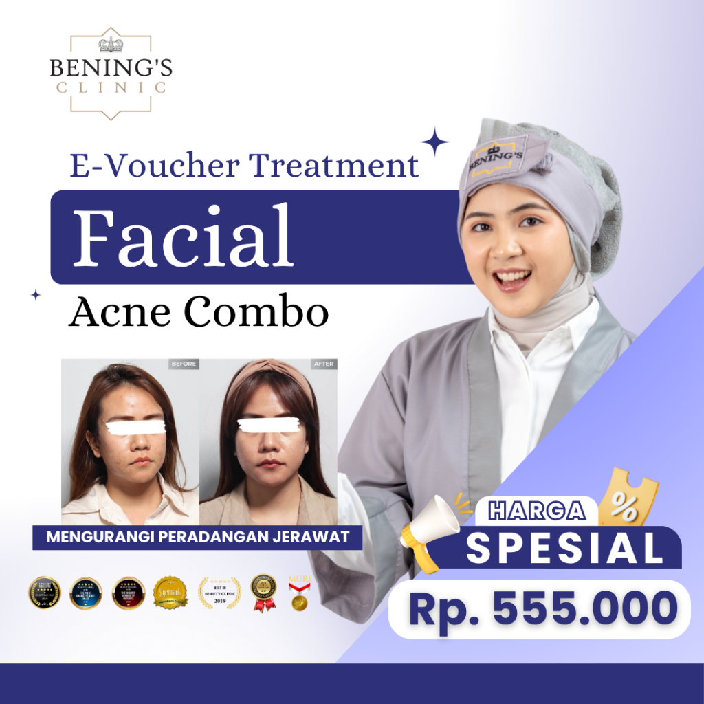 Bening's Clinic  Acne Combo Facial Treatment