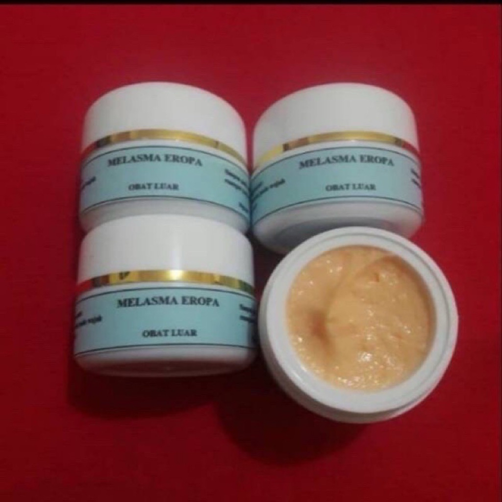 Cream malam melasma eropa/ melasma eropa/ cream melasma flek