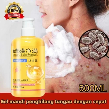 eczema body wash Pengobatan Eksim psoriasis eksim kering Kurap gatal kulit jamur kulit eksim lotion 