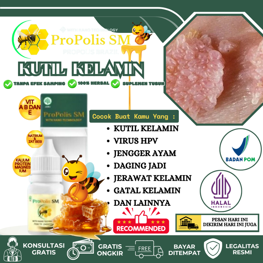 Obat Kutil Kelamin HPV, Obat Tetes Kutil Kelamin, Perontok Kutil Kelamin Pria Dan Wanita, Skin Tag, 