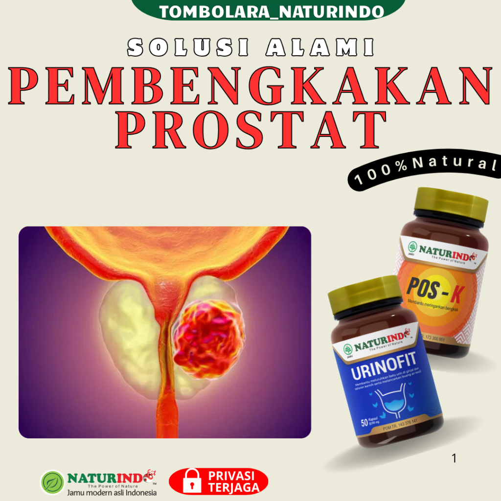 Obat Prostat Herbal Tanpa Operasi Infeksi Saluran Kemih Kanker Prostat Paling Ampuh Pembengkakan Pro
