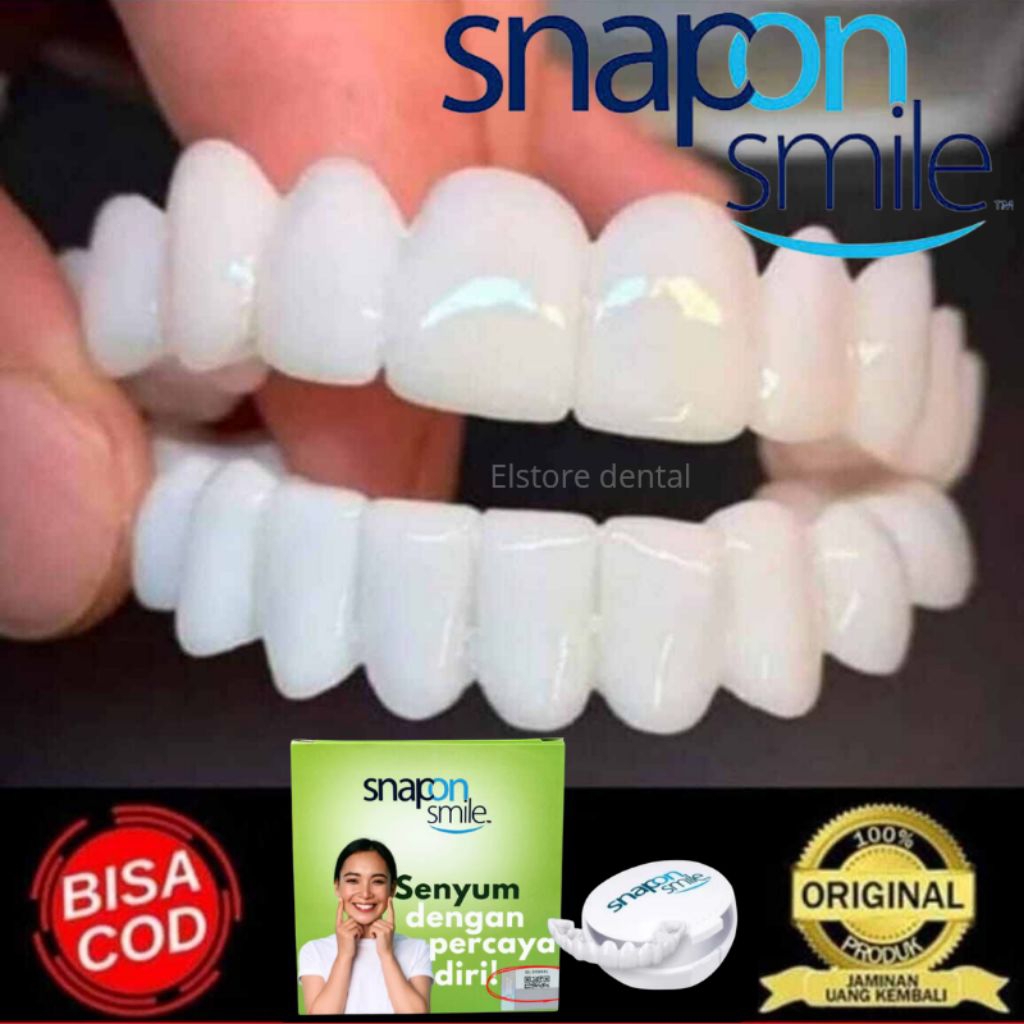 GIGI INSTAN GIGI PALSU SNAP ON SMILE 100%ORIGINAL 1SET ATAS & BAWAH ( BISA COD )