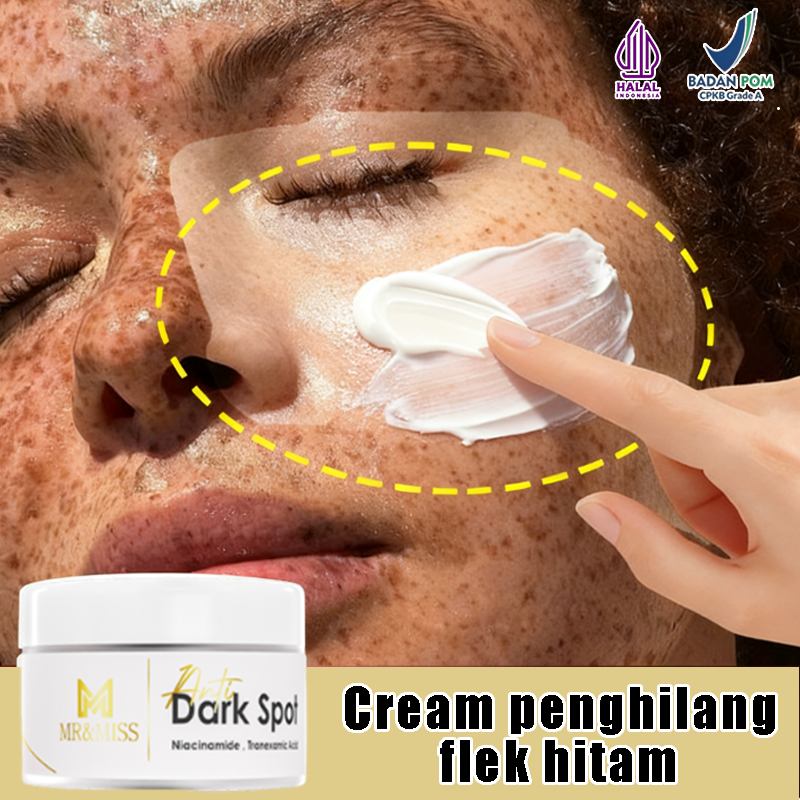 MR&MISS Krim flek hitam membandel ori Menghilangkan flek hitam di wajah Cream penghilang flek hitam 