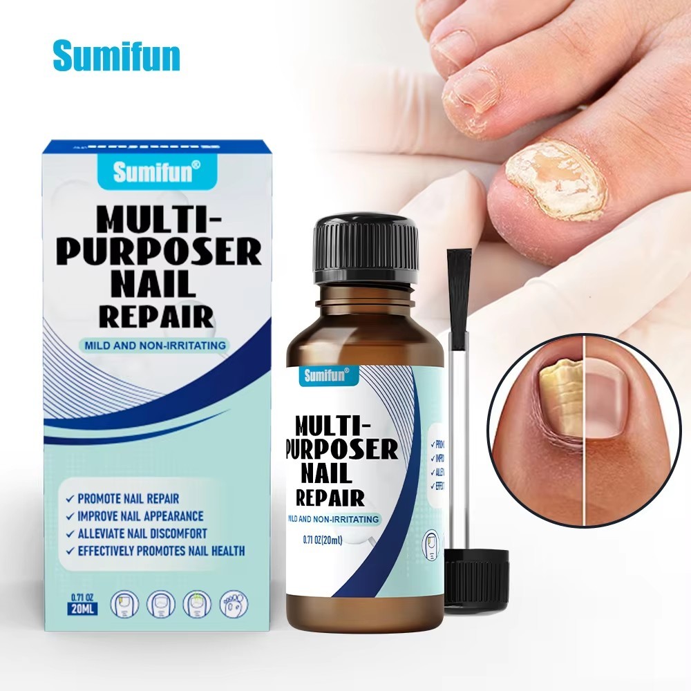 Memulihkan kuku rusak 20ml Obat Kuku Rusak Obat Jamur Kuku Kaki Salep Kuku Jamur Dan Rusak Obat Kuku