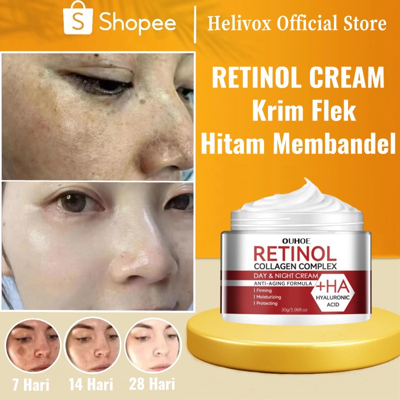 HELIVOX Penghilang flek hitam membandel Retinol whitening cream Menghilangkan flek hitam di wajah Cr