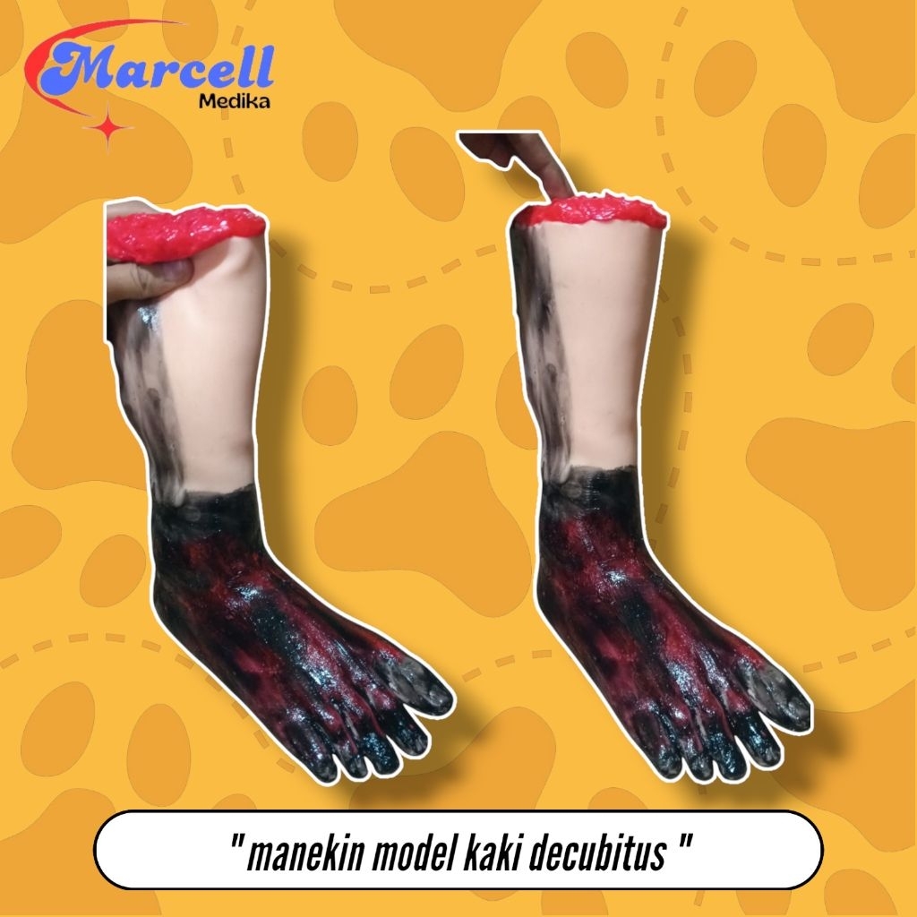 PHANTOM MANEKIN KAKI DECUBITUS / MANIKIN PERAGA KAKI LUKA DECUBITUS
