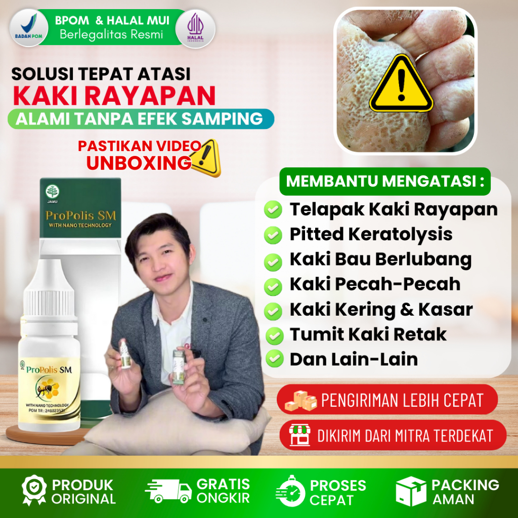 Obat Oles Tetes Kaki Rayapan Tradisional, Obat Telapak Kaki Rayapan, Obat Kaki Rayap, Obat Untuk Tel