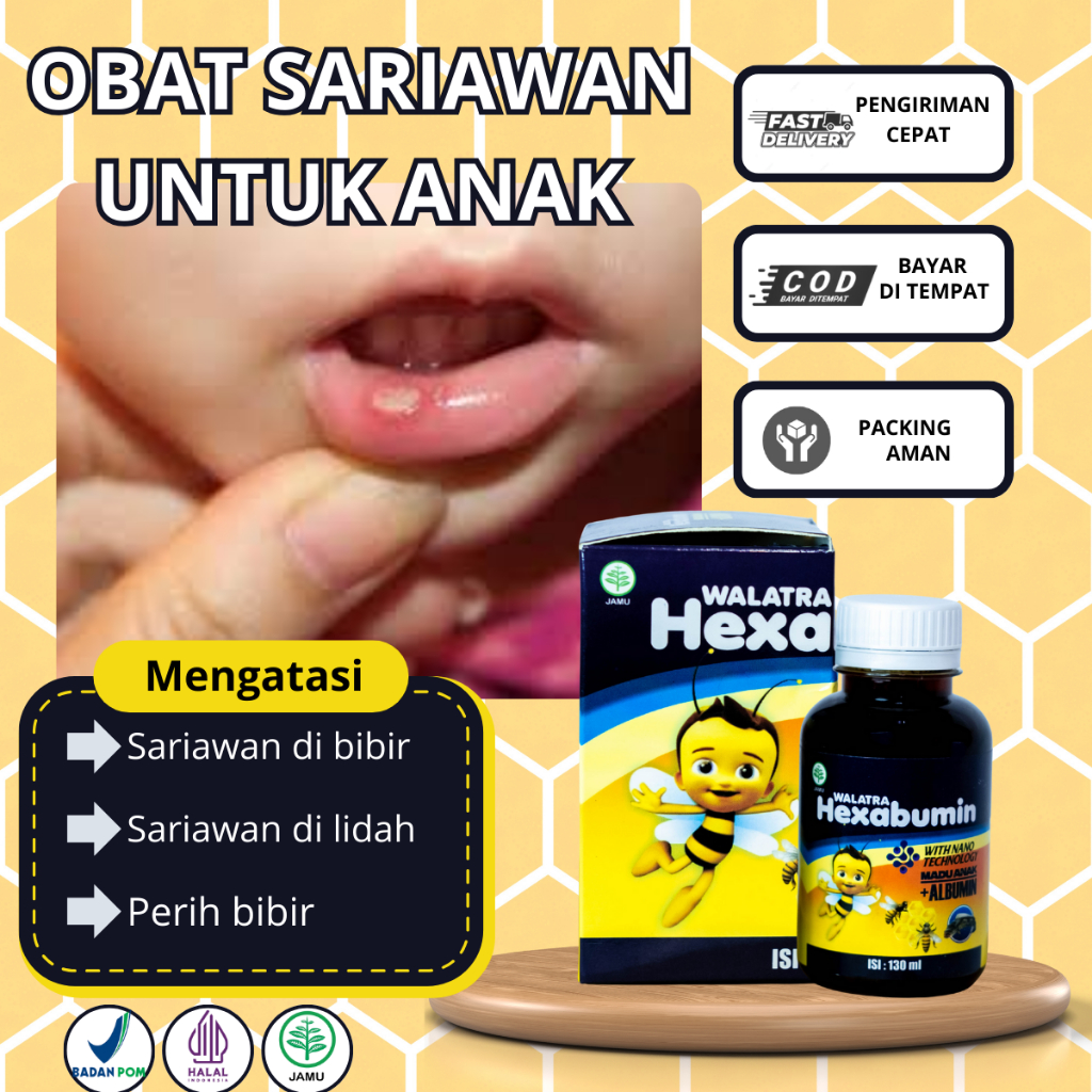 Obat sariawan untuk anak, sariawan di lidah, sariawan di mulut, lidah perih, lidah pecah-pecah-Hexab