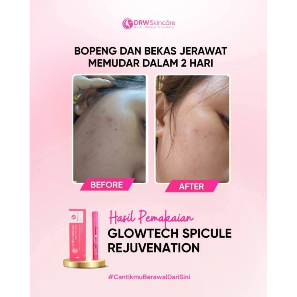 GLOWTECH SPICULE REJUVENATION DRW SKINCARE