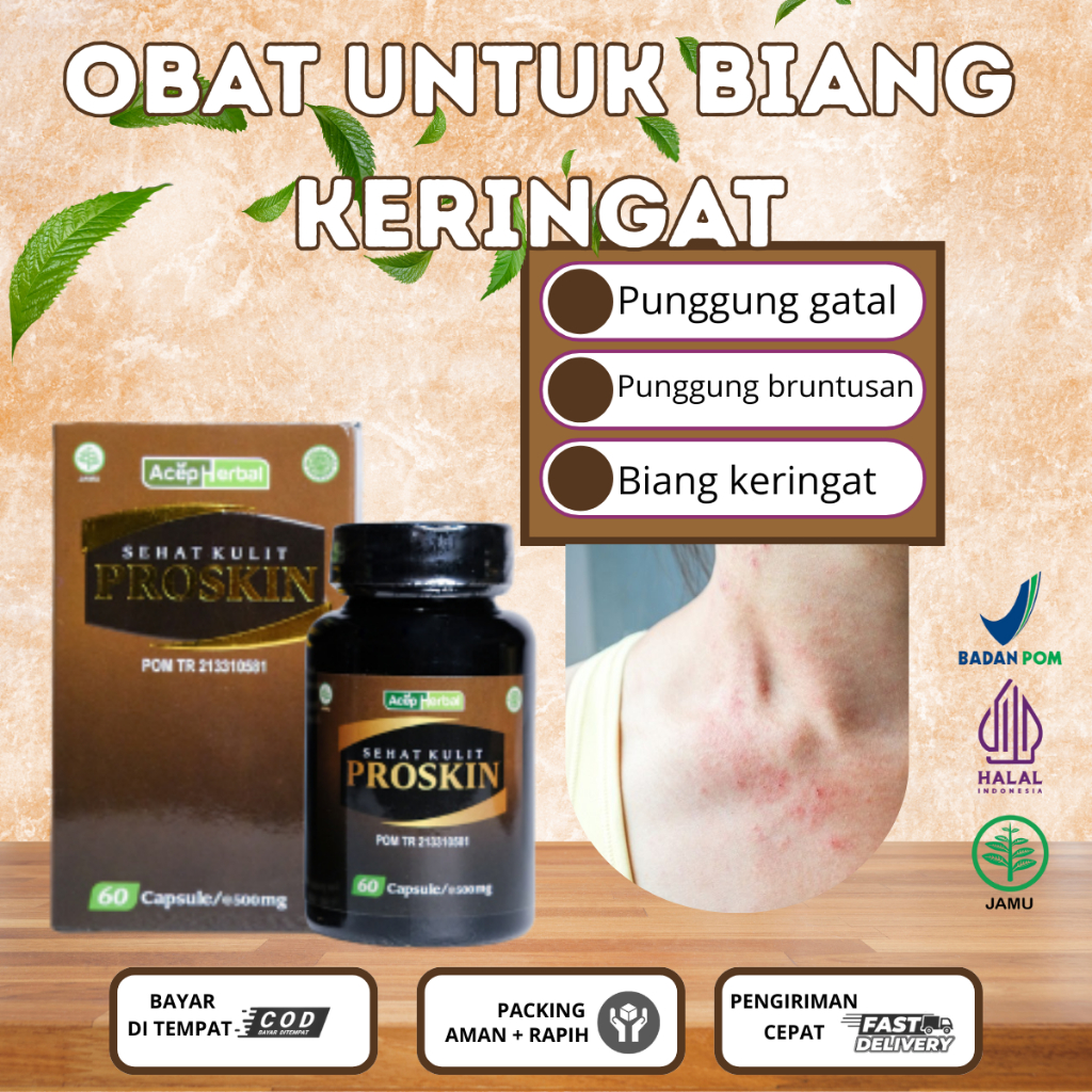 Obat minum untuk gatal di punggung, bintik merah di punggung, biang keringat di badan-Proskin