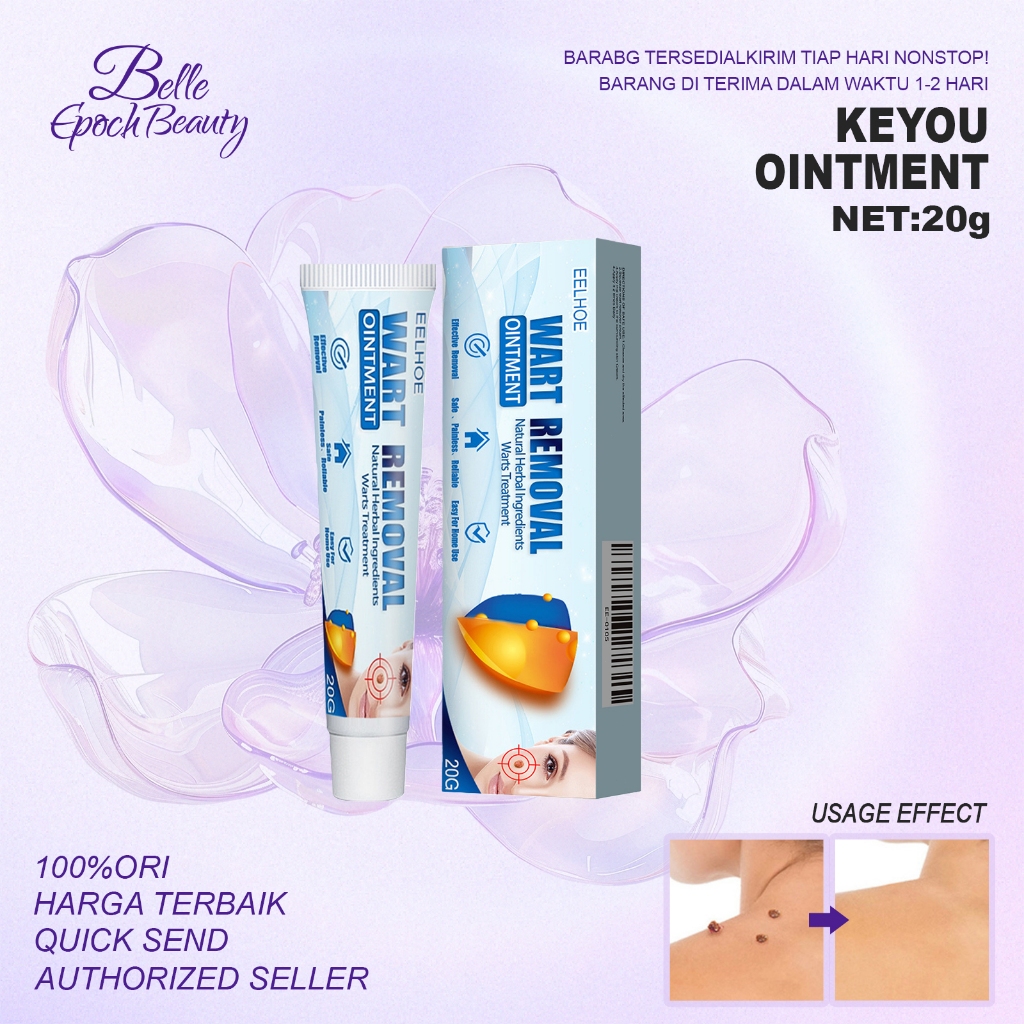 [ORI/COD]EELHOE Wart Removal Cream 20g - 100%ORI Salep Obat Kutil Paling,Salep Penghilang Kutil Dan 
