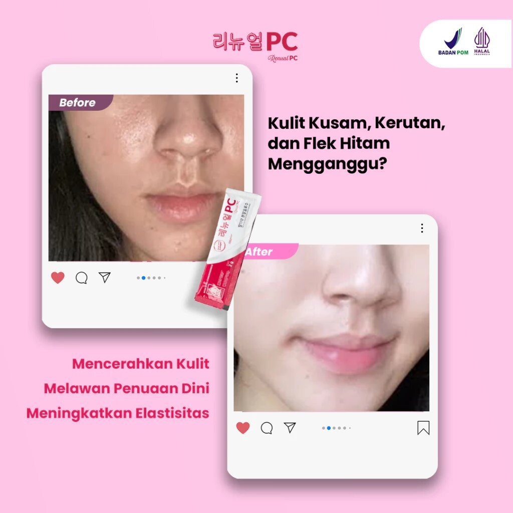 ORIGINAL.. Minuman Kolagen Mencegah Penuaan Dini - Renual Pure Collagen Paket 1 Box isi 30 Sachet