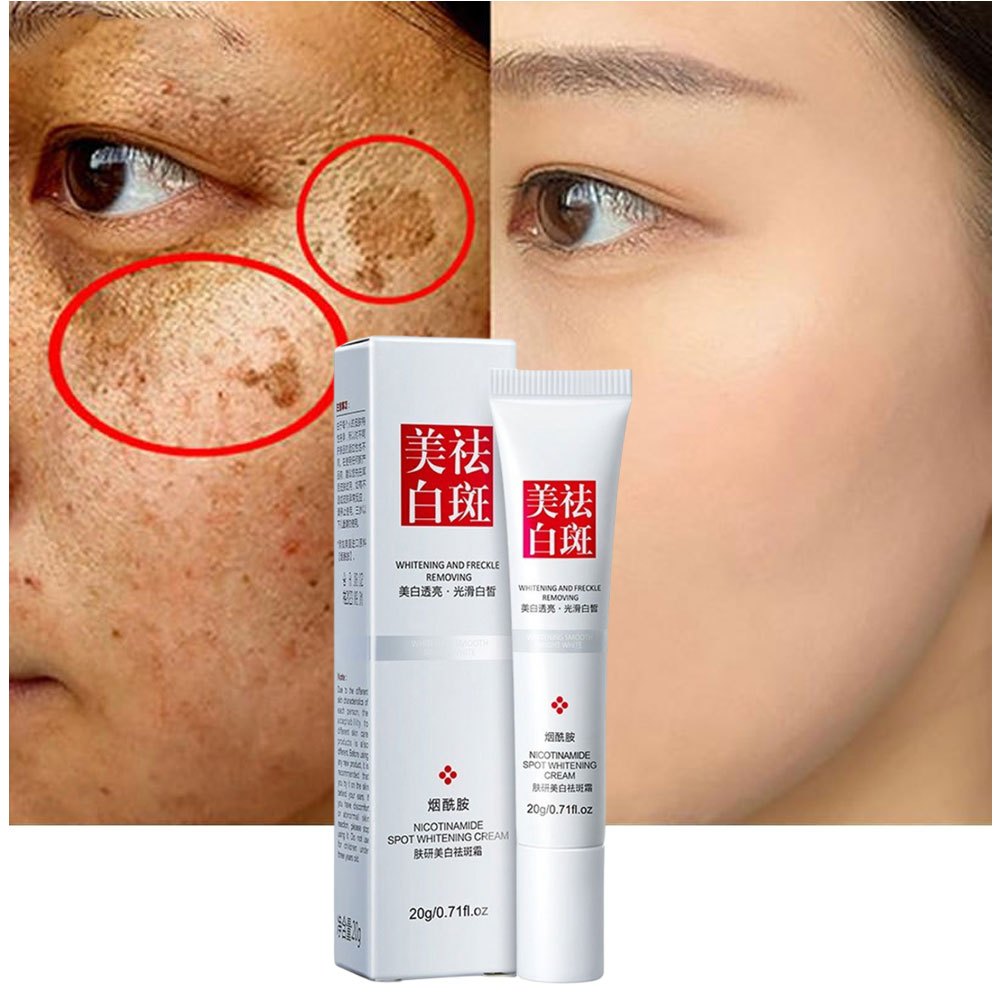 Salep Penghilang Flek Hitam Pemutih Wajah Efektif Menghilangkan Bintik Hitam di Wajah