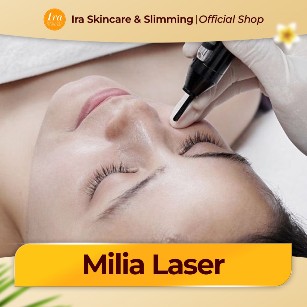 IRA SKINCARE | Milia Laser Removal