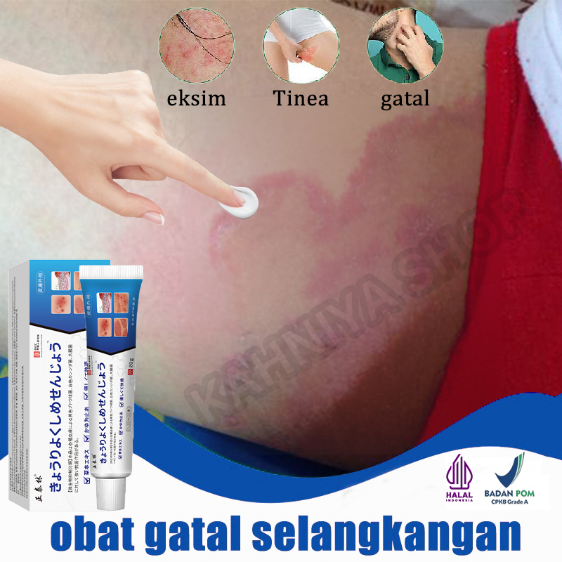Salep gatal paling ampuh salep jamur kulit gatal selangkangan dan hitam salep eksim salap gatal kuli