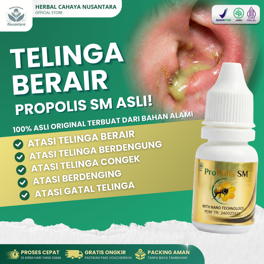 Obat Tetes Telinga Berair Berdengung Congek Telinga Gatal Berdenging Propolis SM Untuk Anak & Dewasa