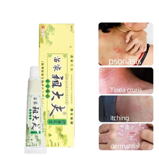 Salep Herbal Cina 15gr Mengatasi Psoriasis Eksim Jamur Alergi Kulit 100% Original