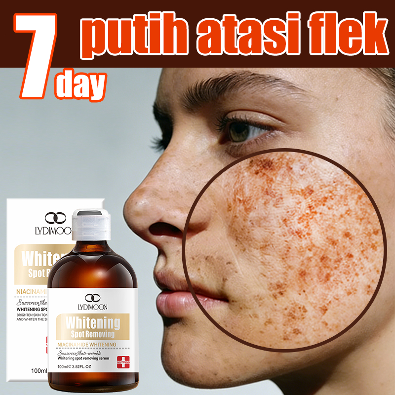 serum flek hitam membandel  serum flek hitam  serum flek hitam dan wajah kusam 100ml   penghilang wa