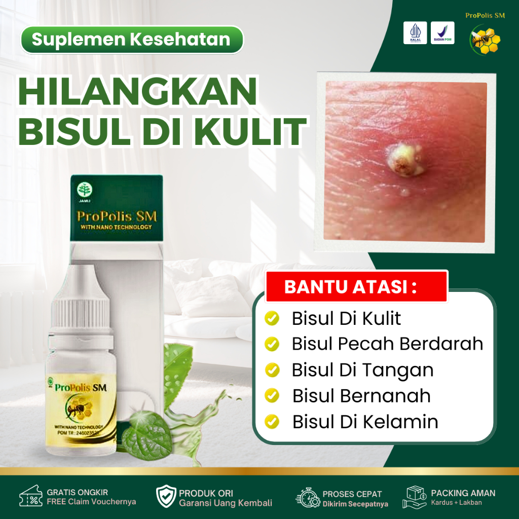 Propolis SM - Obat Bisul, Bisul Di Tangan, Bisul Meradang, Bisul Di Kaki, Benjolan Bisul Cenang, Bis