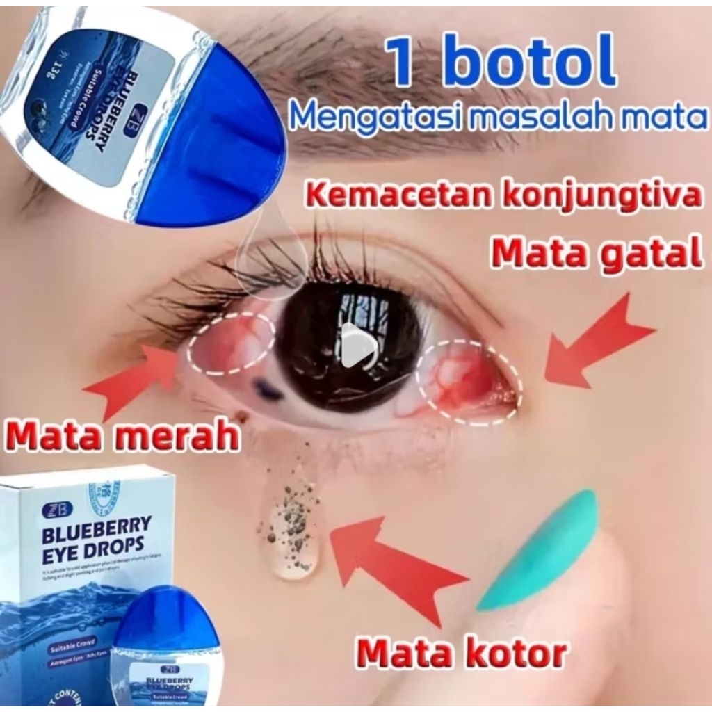 Blueberry Eye Drops 15ml – Tetes Mata Herbal untuk Kenyamanan Mata