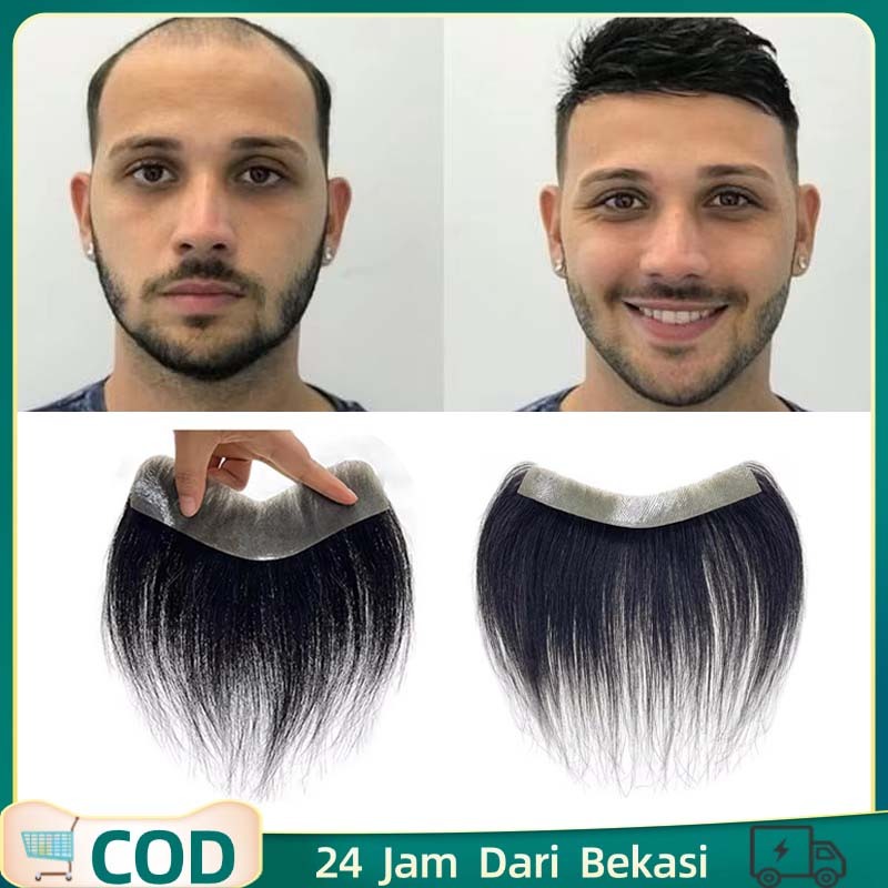 16cm X1.5cm Toupee Hair Line Hair Toupe Toupee Human Hair Bentuk V Rambut Toupee Pria