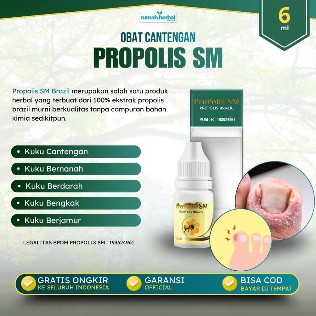 Propolis SM Brazilian - Obat Cantengan Obat Kuku Anti Infeksi Jamur Bakteri Cantengan Bau Busuk Gata